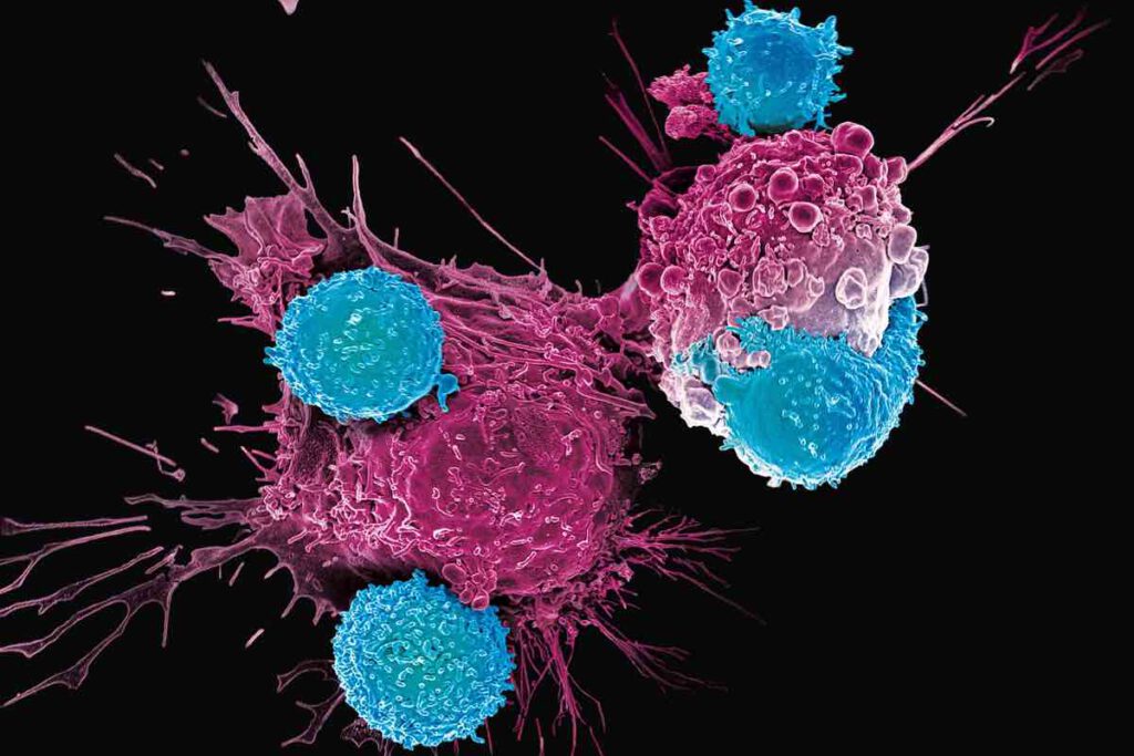 CAR-T-cellen vallen kankercel aan