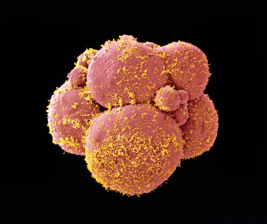 Menselijke embryo