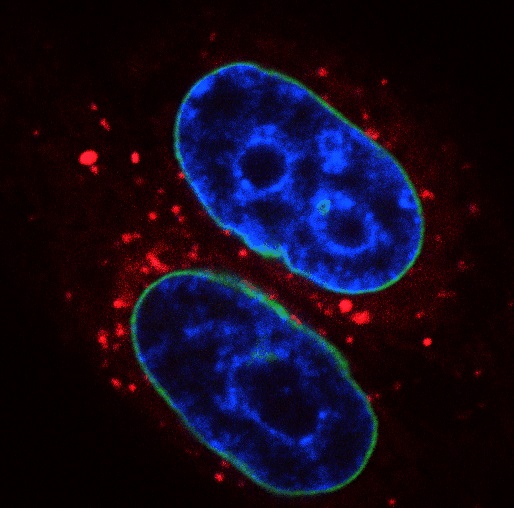 Nucleofagie