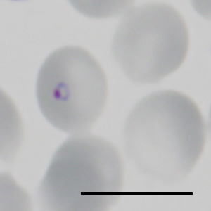 Plasmodium falciparumparaciet besmet rood bloedlichaampje