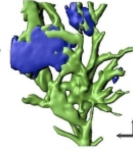 Stercellen met beta-amyloïdeplaques