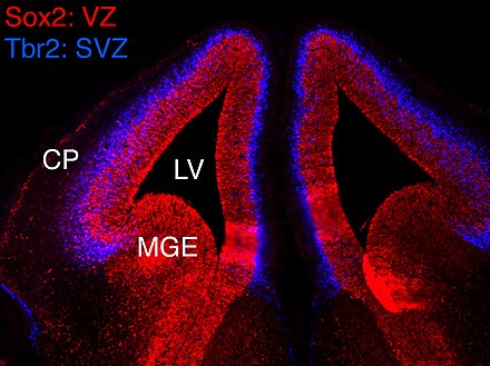 De subventriculaire zone